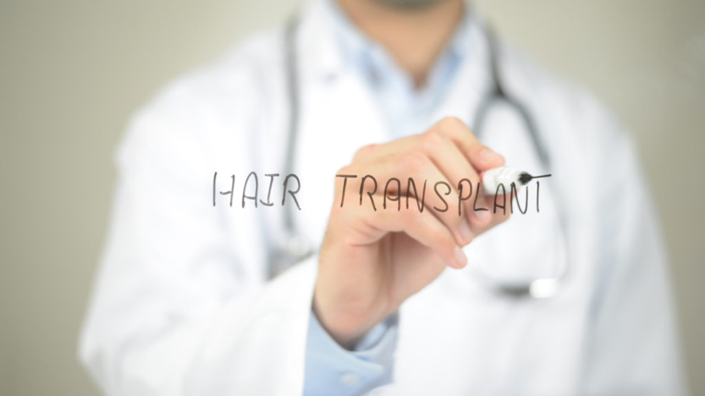how long do hair transplant results last