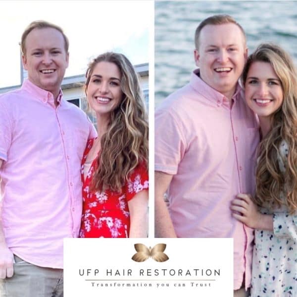hair restoration review