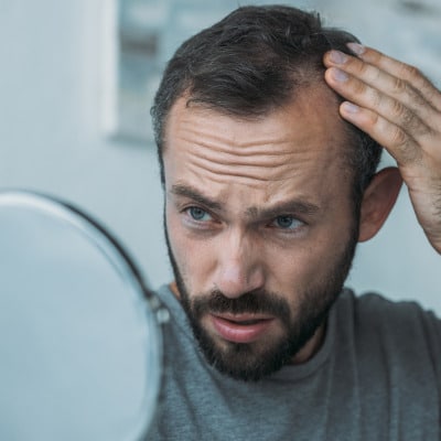 causes of early hair loss