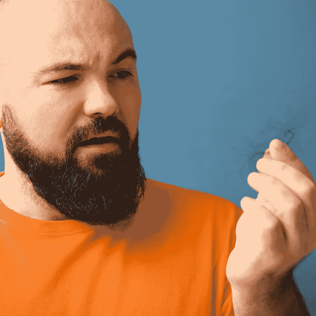 balding (2)