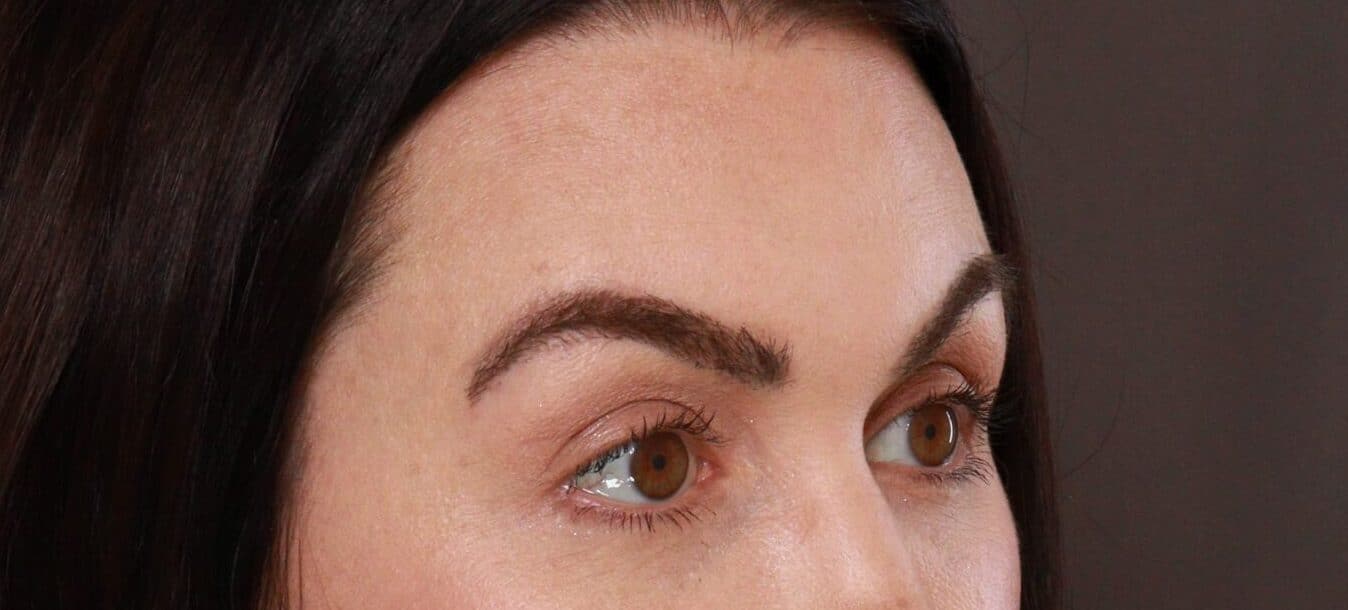 After Image: Eyebrow Hair Transplant by Dr. Manning - right-front-oblique