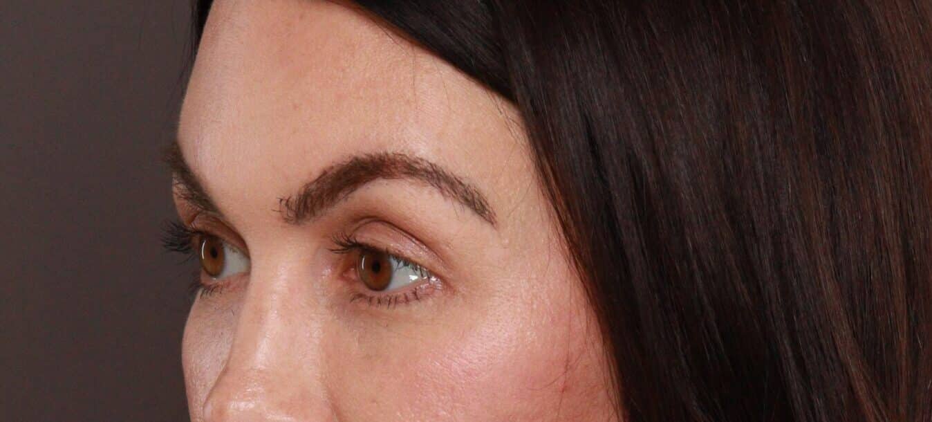 After Image: Eyebrow Hair Transplant by Dr. Manning - left-front-oblique