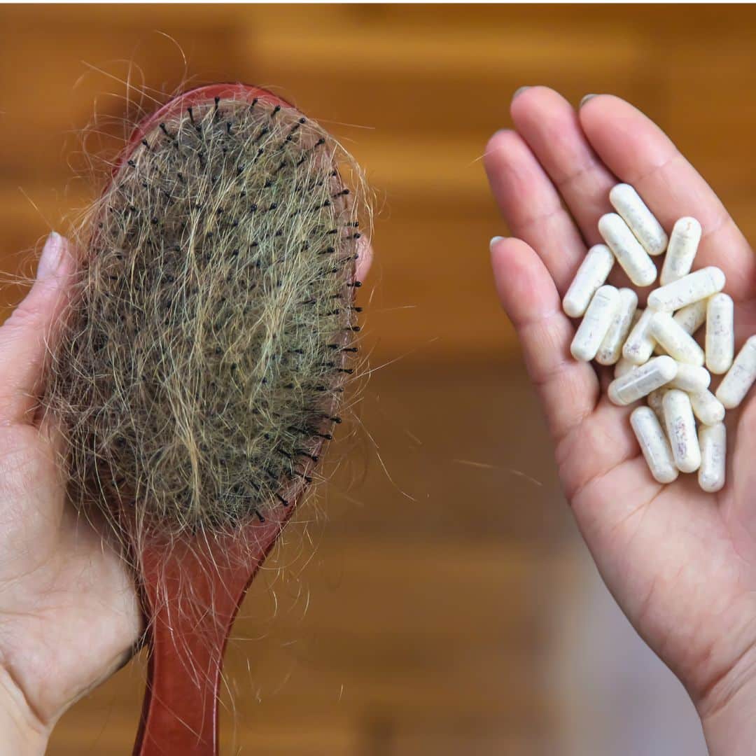 hair loss medication