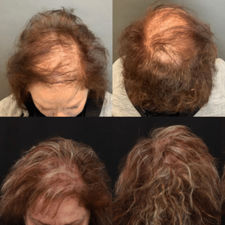 CH b&A