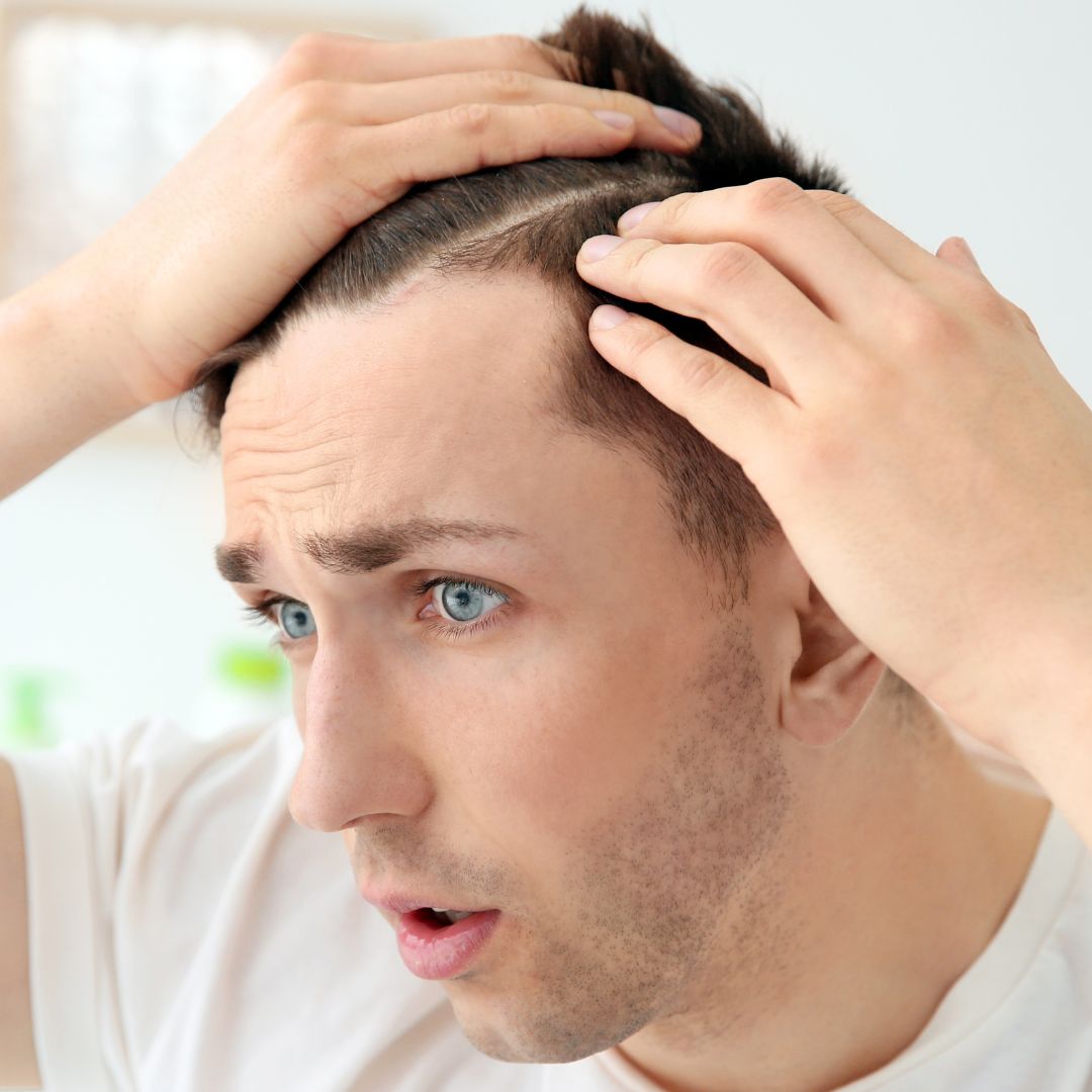 teen thinning hair