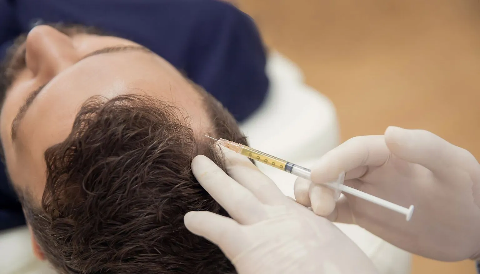 Hair injection 1536x878 Hair injection 1536x878