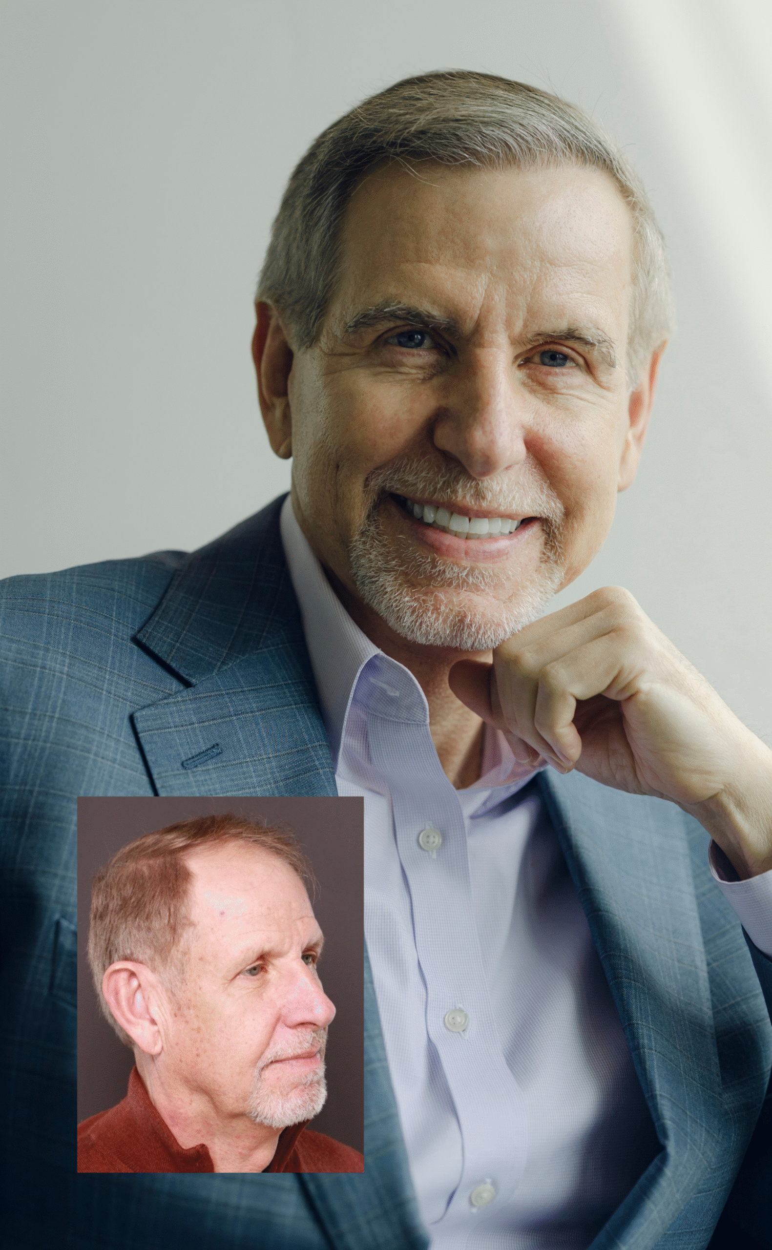 Facial Plastic Surgery UFP Hair Restoration