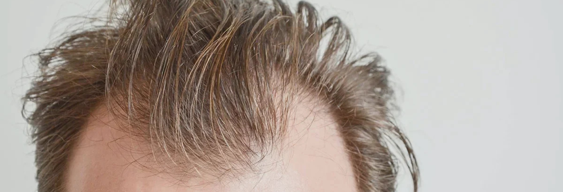 UFP Hair Restoration