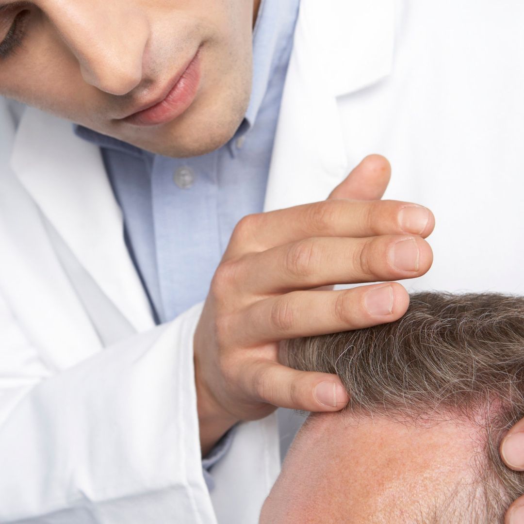 best age hair transplant