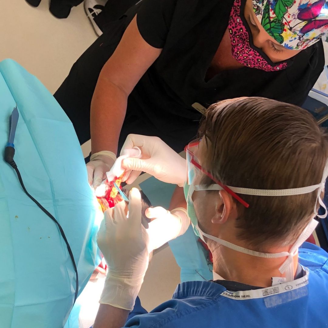 FUE Transplant (9)