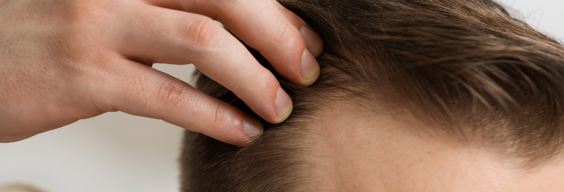 UFP Hair Restoration Draper, Layton, Heber