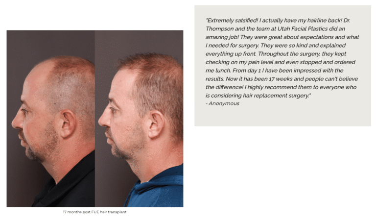UFP Hair Restoration