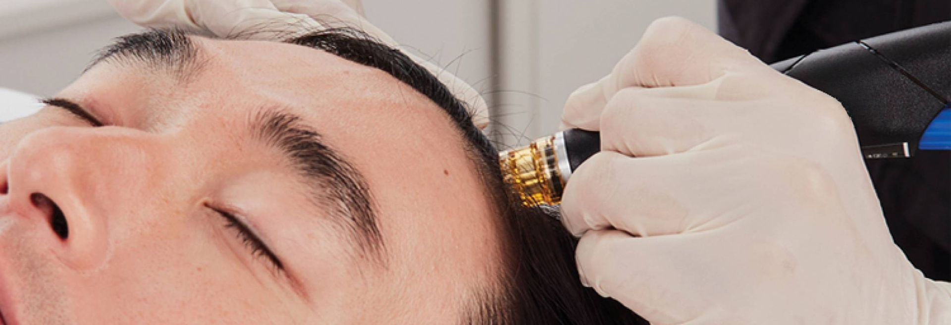 UFP Hair Restoration
