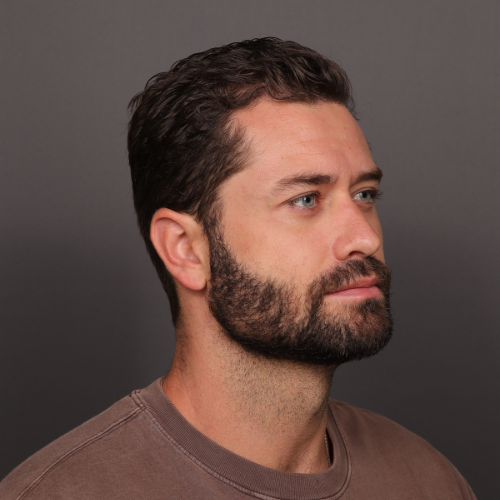 After Image: FUE NeoGraft Hair Transplant - right-front-oblique