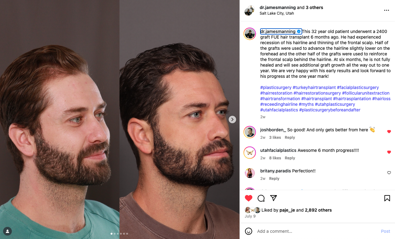 UPF Hair Restoration