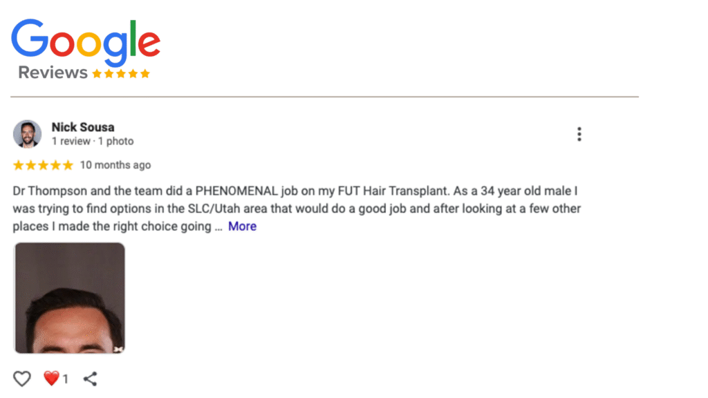 UFP Hair Restoration 5 Star Reviews in Salt Lake City, UT