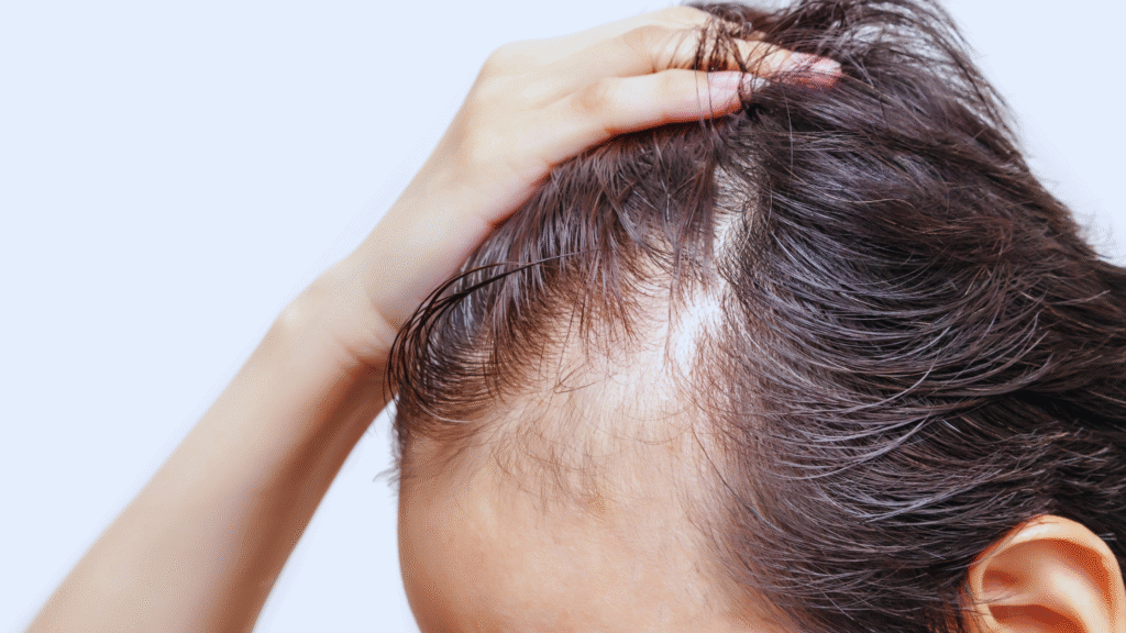 UFP Hair Restoration