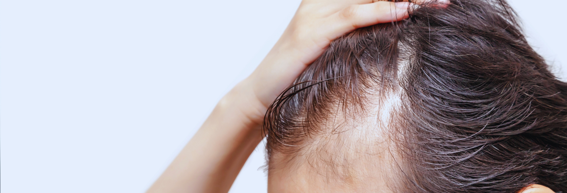 UFP Hair Restoration
