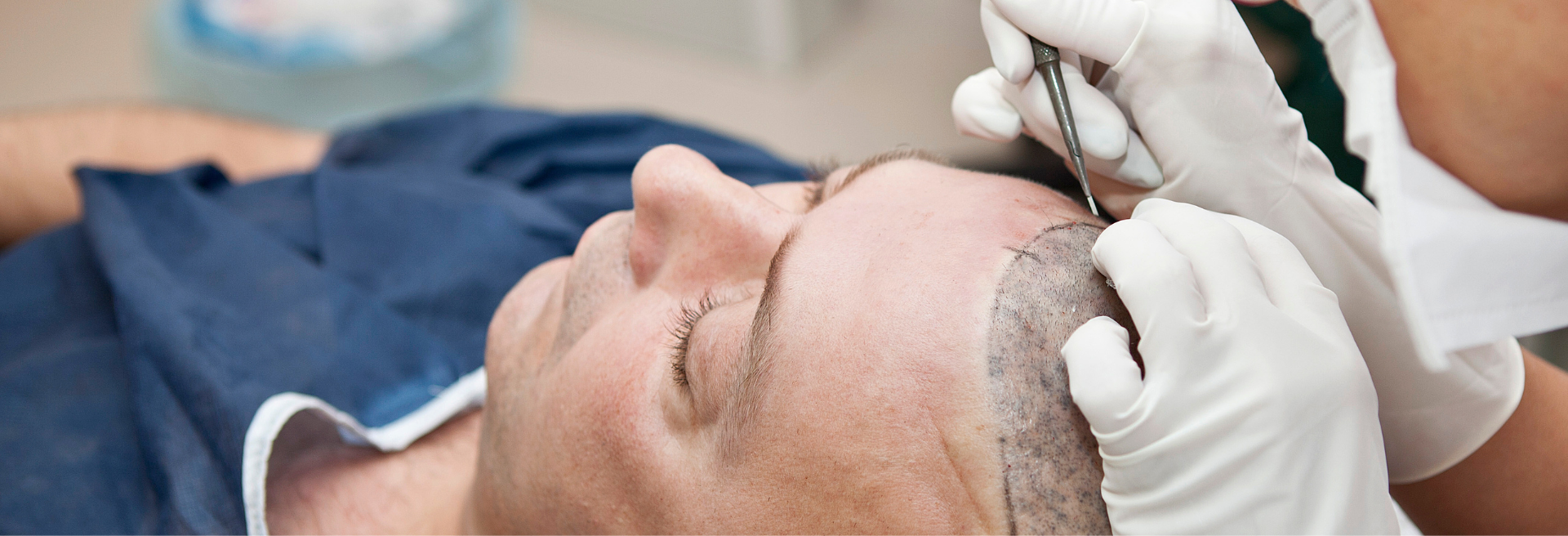 UFP Hair Restoration