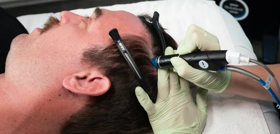 Hydrafacial Keravive