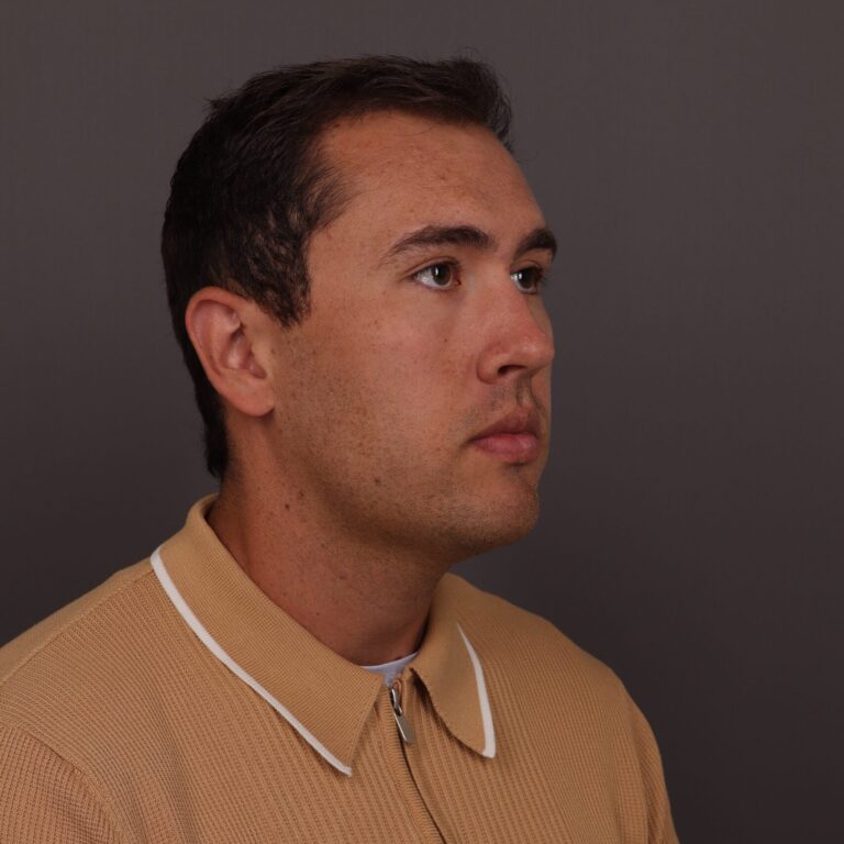 After Image: FUT Hair Transplant, 1500 Grafts - right-front-oblique