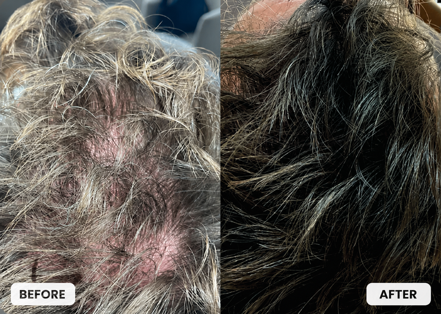 HydraScalp Results