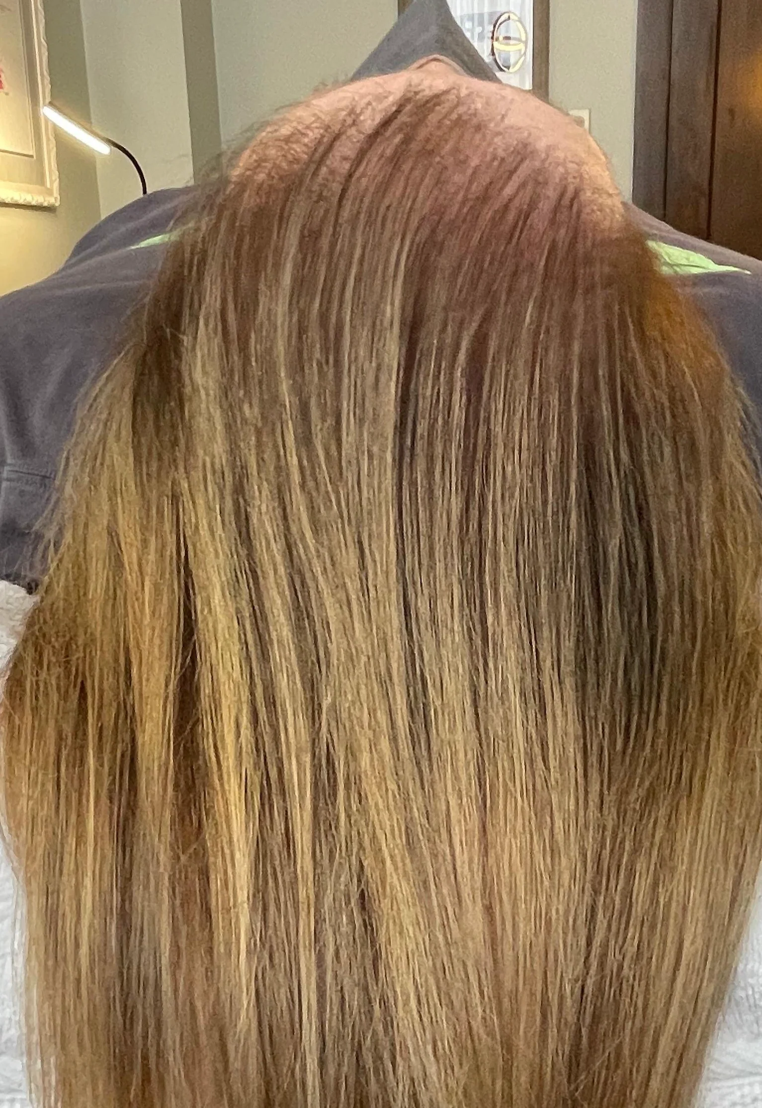 After 1 Hydrafacial HydraScalp with Keravive™ Treatment and Daily Use of HydraScalp with Keravive™ Peptide Spray Includes daily use of take-home peptide spray. Individual results may vary.